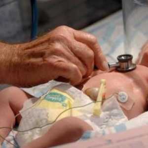 Boala hemolitica a nou-născutului, tratamentul, cauzele