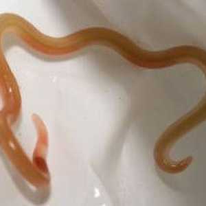 Worms (viermi intestinali), de culoare roșie în copil și adult