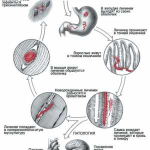 Viermii intestinali (viermi), care trăiesc în mușchi umane, simptome și fotografii