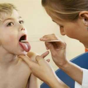 Bolile cronice pulmonare supurative la copii