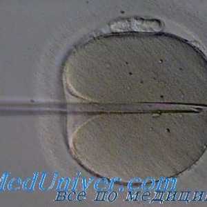 Fertilizarea in vitro (FIV). Oportunități și perspective