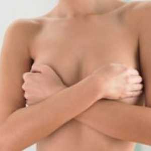 Eczema pe piept mamelonul: tratament, simptomele, cauzele
