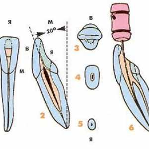 Aspecte endodontic ale morfologiei dinților permanenți inferiori