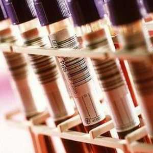 Ce teste de sânge trec în boala pancreatica?