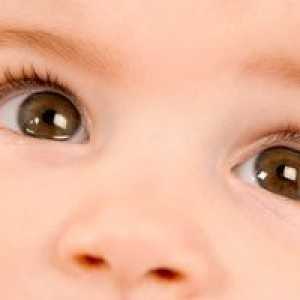 Cataracta la copii: tratament, cauze, simptome, semne
