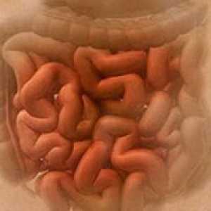 Enterocolită infectie intestinala