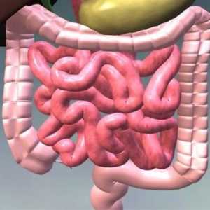 Kolonoptoz intestinului prolapsul colonului transversal