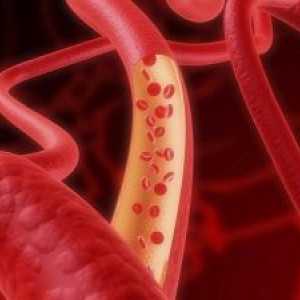 Sângerarea cauzate de deteriorarea vaselor de sange