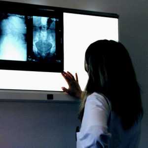 Tratamentul în Spania centru de imagistica de diagnostic dr Manchon barcelona