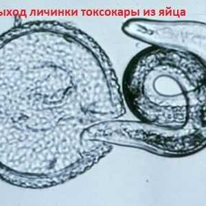Larvele și ouă Toxocara toxocarioza viscerala