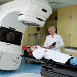 Radioterapie si terapie directionate in cancerul gastric