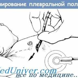 Metode de drenaj cavitatea pleurală a unui copil nou-născut în spatele