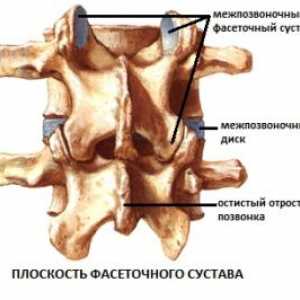 Intervertebrale (dugootroschatye) articulații