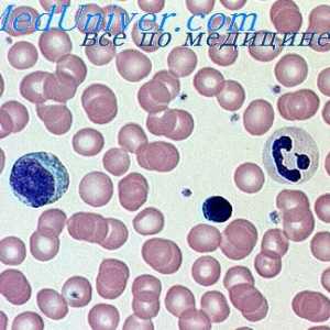 Distrugerea hemoglobinei. varietate de anemii