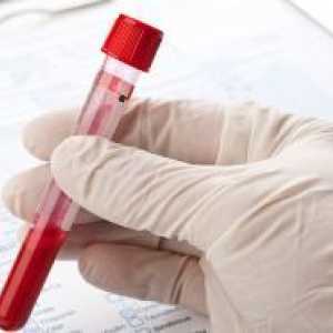 Poate fi hemoglobina scăzută și creșterea vitezei de sedimentare a hematiilor de hemoroizi?