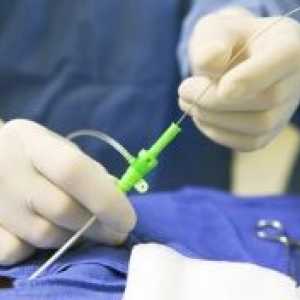 Violarea spermatogenezei: cauze, tratament