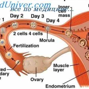 Locul anormal implantarea embrionului. sarcinii ovarian si abdominale