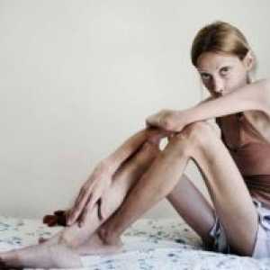 Anorexia nervoasa: tratament, simptome, semne, cauze
