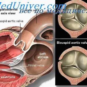 Educație valve aortice. Separarea trunchiului arterial fetal