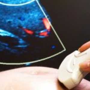 Este periculos cu ultrasunete?