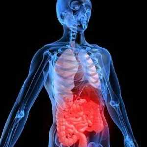 Acută sângerare la nivelul tractului gastro-intestinal inferior