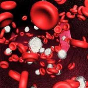 Anemia acută care rezultă din pierderea de sânge