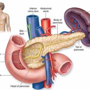 Pancreatită acută în diabetul zaharat