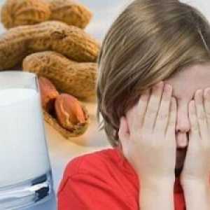 Alergii alimentare la copii mai mari de 7 ani