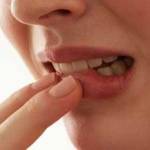 Carcinomul scuamos al cavității orale: tratament, simptome, prognosticul