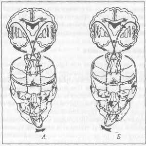 Nervului hipoglos, și rolul său în durerea facială