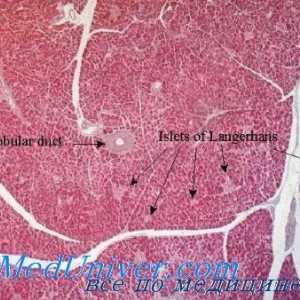 Pancreasul este o formă severă de diabet. glomeruloscleroza diabetică
