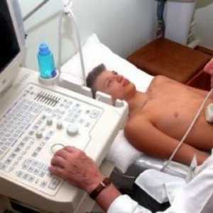 Polip pe ultrasunete