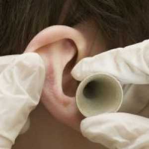 Înfrânt ureche: atunci când primesc medicamente cu herpes zoster