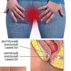 Odata ce durerea constipatie in anus (deschidere anal, anus)