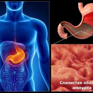 Cauzele gastrită cronică