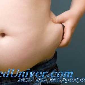 Cauzele și mecanismele de obezitate. obezitate hipotalamică