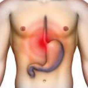 Cauzele ulcerului gastric. De ce este ciuma?