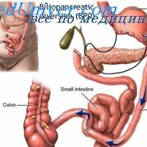 Digestia de carbohidrați. digestia Secvență de carbohidrați în tractul gastro-intestinal