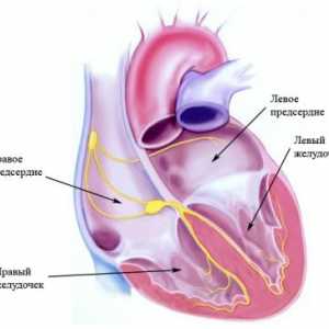 Sistem de conducere cardiacă