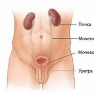 Cancerul de vezica urinara si uretra la femei, la barbati: simptome, tratament, stadiul, semne