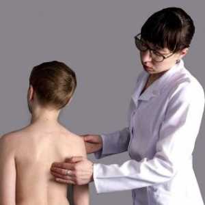 Spina bifida la copii: semne, simptome, cauze, tratament