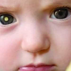 Retinoblastomul la copii: simptome, tratament, cauze, simptome