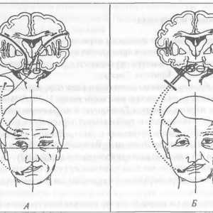 Rolul nervului facial la manifestările de durere facială
