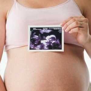 Pelvis al femeilor gravide