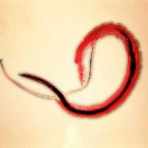 Bilharzia (schistosomiasis, bilharzia), agentul cauzal al sângelui (japonez) trematode