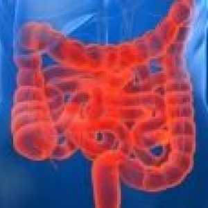 Sindromul de intestin scurt: tratament, simptome