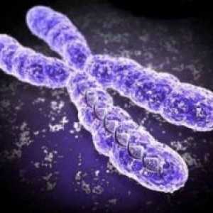 Sindromul cromozomului X fragil la copii
