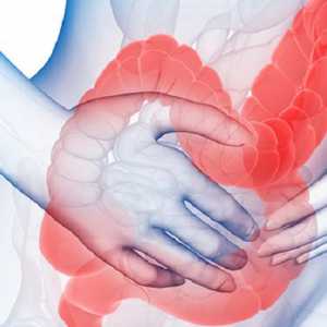 Sindromul de intestin iritabil in timpul sarcinii