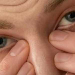 Sindromul de ochi uscat, tratament, simptome, cauze