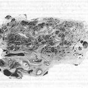 Componentele stromale ale pancreasului